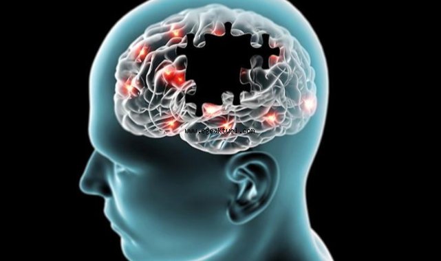 Buca Belediyesi Alzheimer’a karşı farkındalık yaratacak