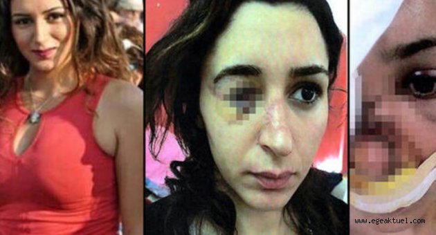 Dehşeti yaşayan Tuğçe, hukuk mücadelesi başlattı