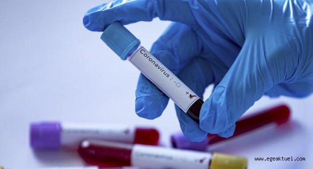 DEÜ'de korona testi yapılmaya başlandı
