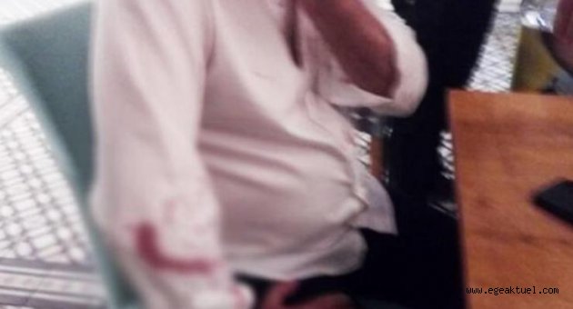 Didim Belediye Başkanı Ahmet Deniz Atabay'a beyzbol sopalı saldırı