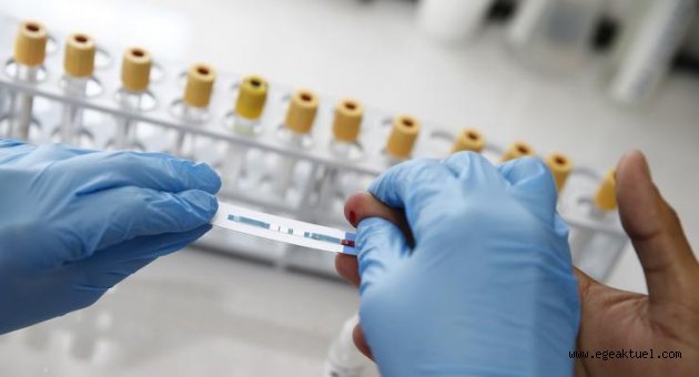 Konak'tan ücretsiz ve anonim HIV testi
