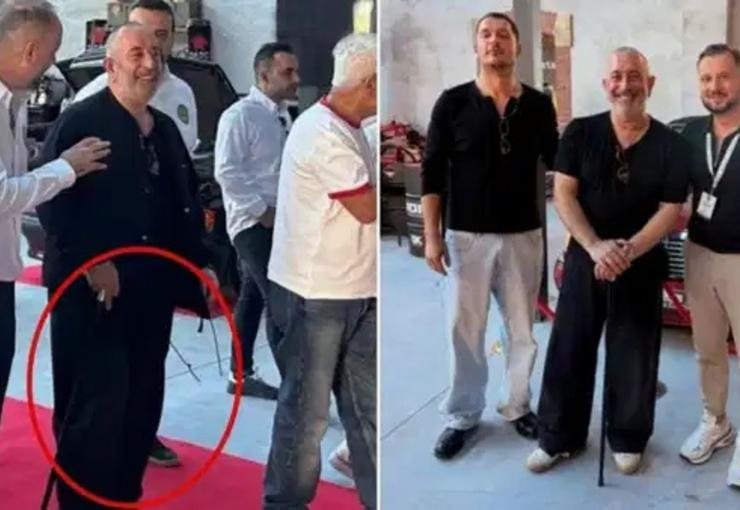 Cem Yılmaz Bastonlu Görüntülerine Yanıt Verdi: Sağlık Durumunu Açıkladı